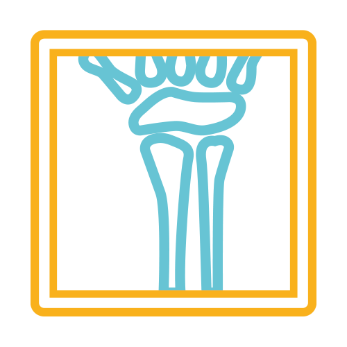 Cubito y Radio Bilateral (Antebrazo)