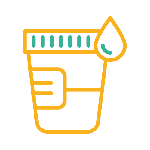 Serotonina (5 Hidroxitriptamina) Orina