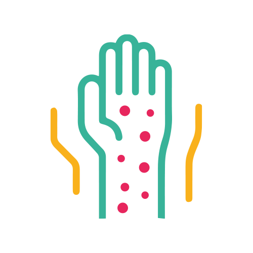 Ac. Anti - Varicela IgM